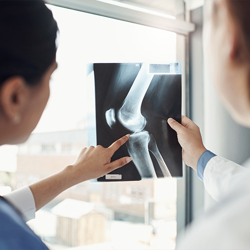 doctors going over xray bone density exam